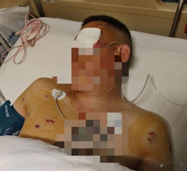 河南，男子从银行取出170万现金，刚走到银行门口就被歹人抢劫。男子跟歹徒在门口缠