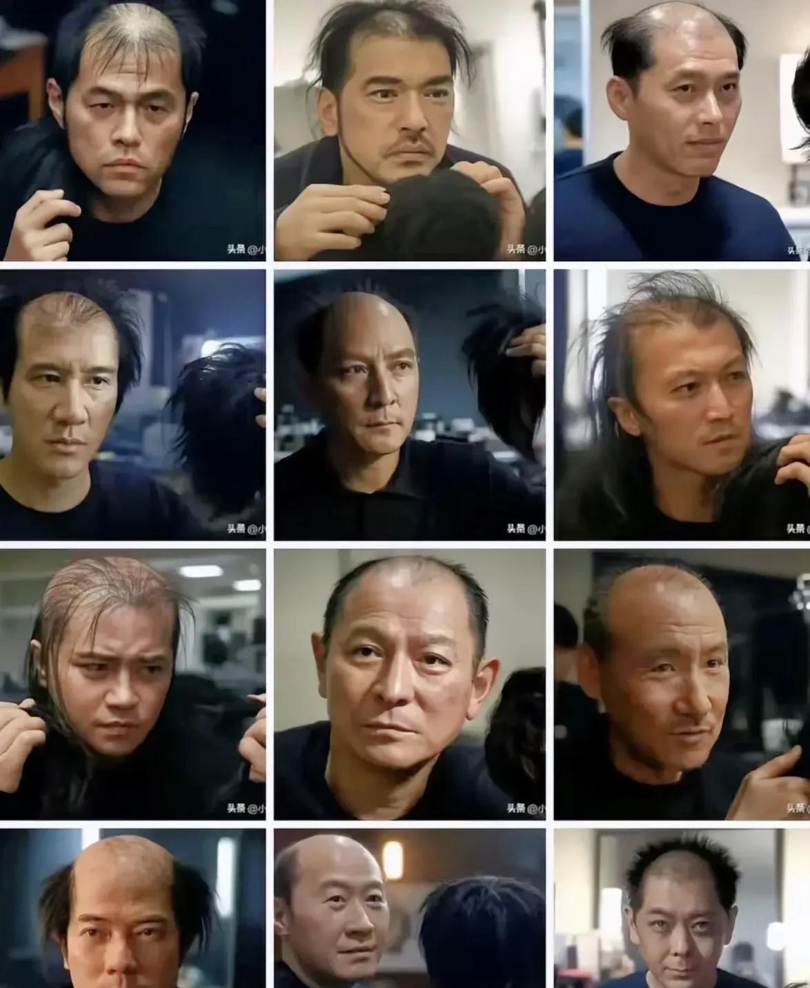 论头发的重要性到底有多重要，看看男神谢顶之后还是男吗？都说看一个男人帅不帅，就