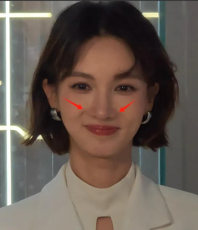 金晨的脸越来越奇怪，以前是嘴歪现在鼻子也歪了...