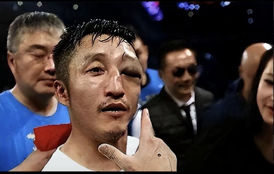 图一邹市明肿的像桃子的乌眼青，看着都令人心疼；图二冉莹颖和邹市明衣着得体，表情