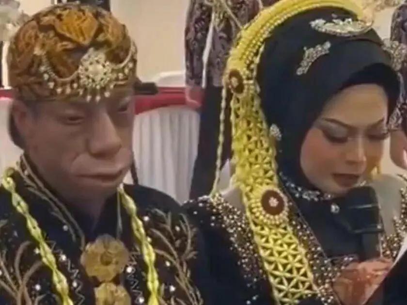 反转！印尼“马脸新郎”爆火别拿外貌当尺子，真爱从不看脸！