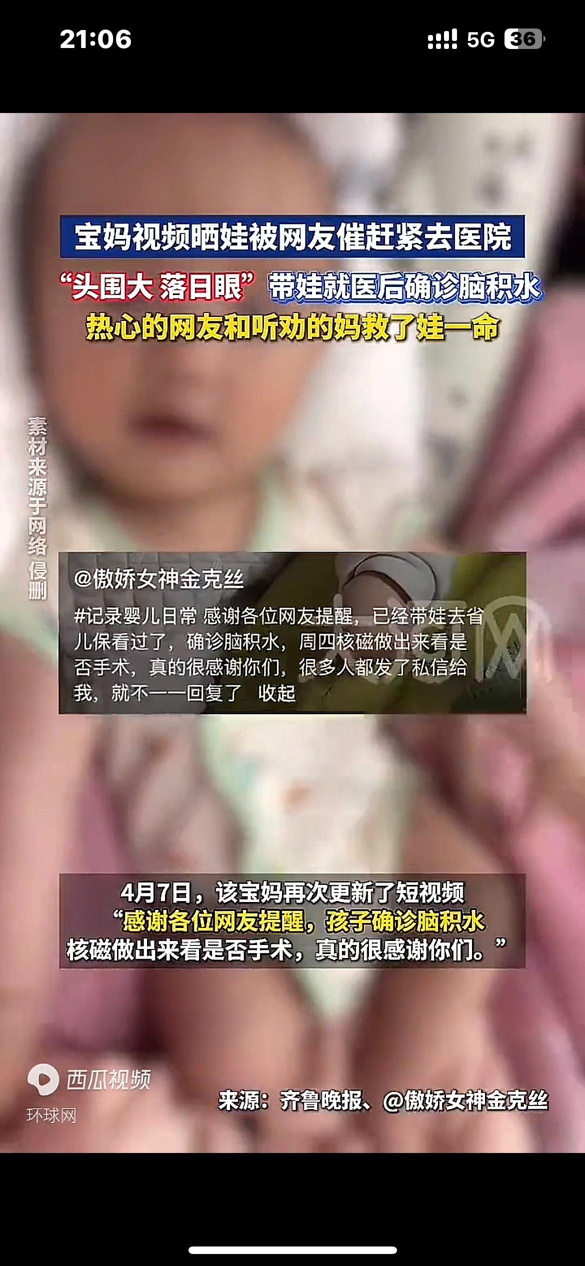 宝妈晒娃，网友提醒“头围大落日眼，赶紧去医院！”带娃就医后确诊脑积水近日，一