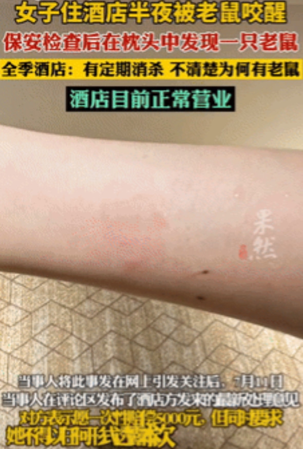 太恶心了！江西南昌，一女子入住酒店，半夜睡觉时，隐约间手臂感到很疼，当醒过来后就