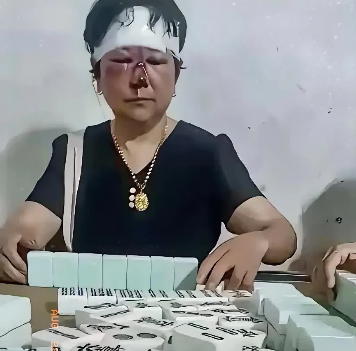 陕西一女子晚上去麻将馆找丈夫，结果看到超离谱的一幕。有个女子头部和鼻子都