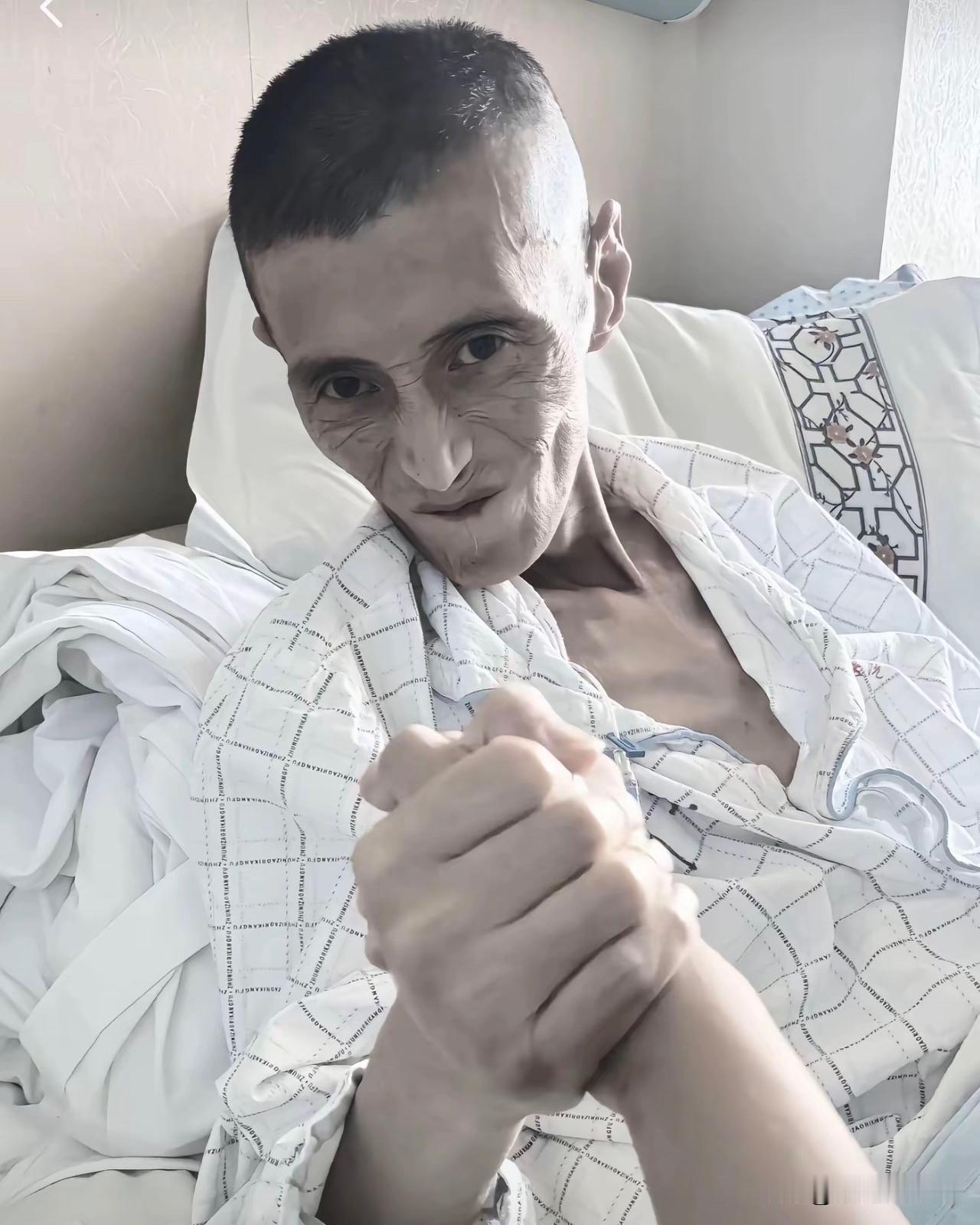 电焊工江小鱼走了，他最后一句话是：“抱歉我已尽力了，阵地没守住！”食道癌让他