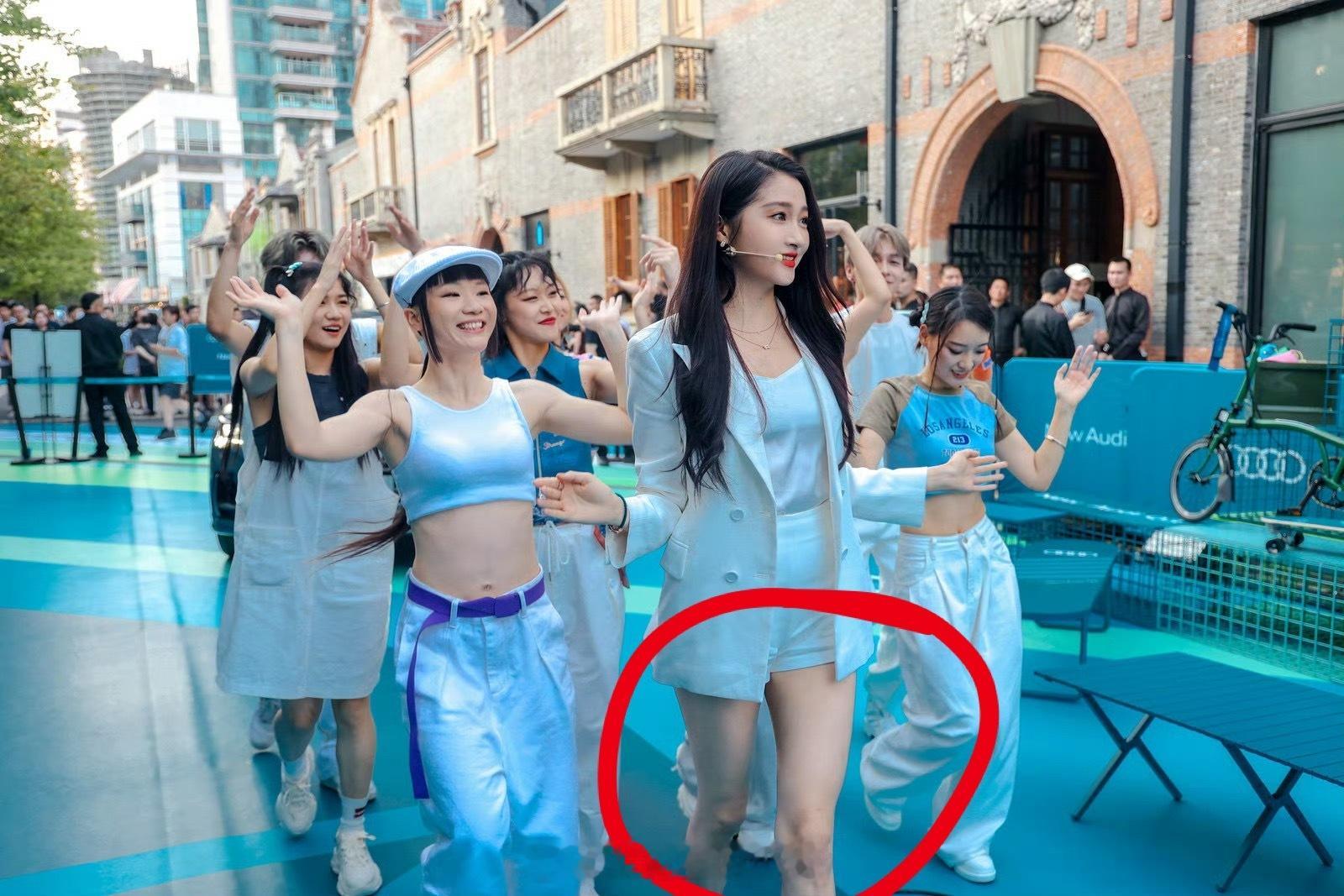 关晓彤奥迪汽车代言人没别的意思，单纯好奇图1这个腿是什么情况[？？？][？？？][