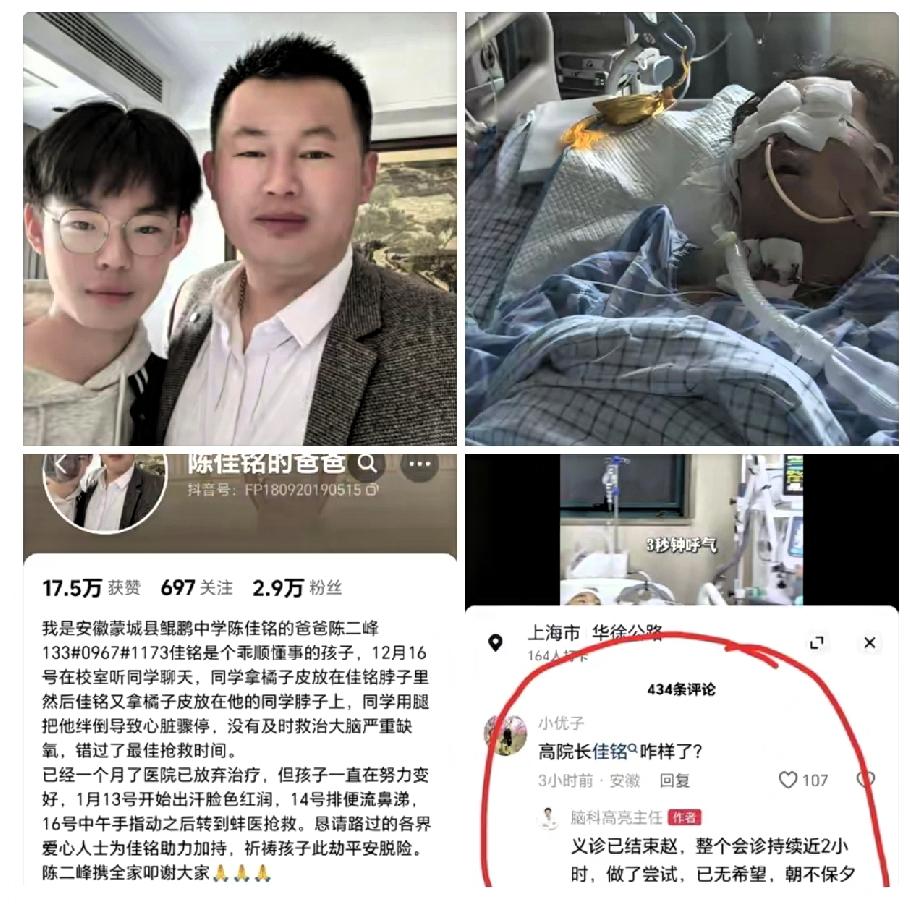 因为和同学打闹摔到后脑勺的陈佳铭脑死亡了。救不过来了！上海脑科专家高主任今天
