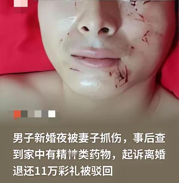 娶妻开盲盒？新婚夜新娘拒绝性生活并抓花丈夫脸，藏精神药被揭穿，11万彩礼不退，这