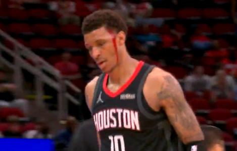 火箭防守悍将史密斯真是太硬了！在今日火箭对阵鹈鹕的首节比赛中，史密斯头部与米