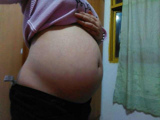 六个月宝宝出现“斗鸡眼”, 婆婆毫不在意, 哪知检查后, 大哭后悔!