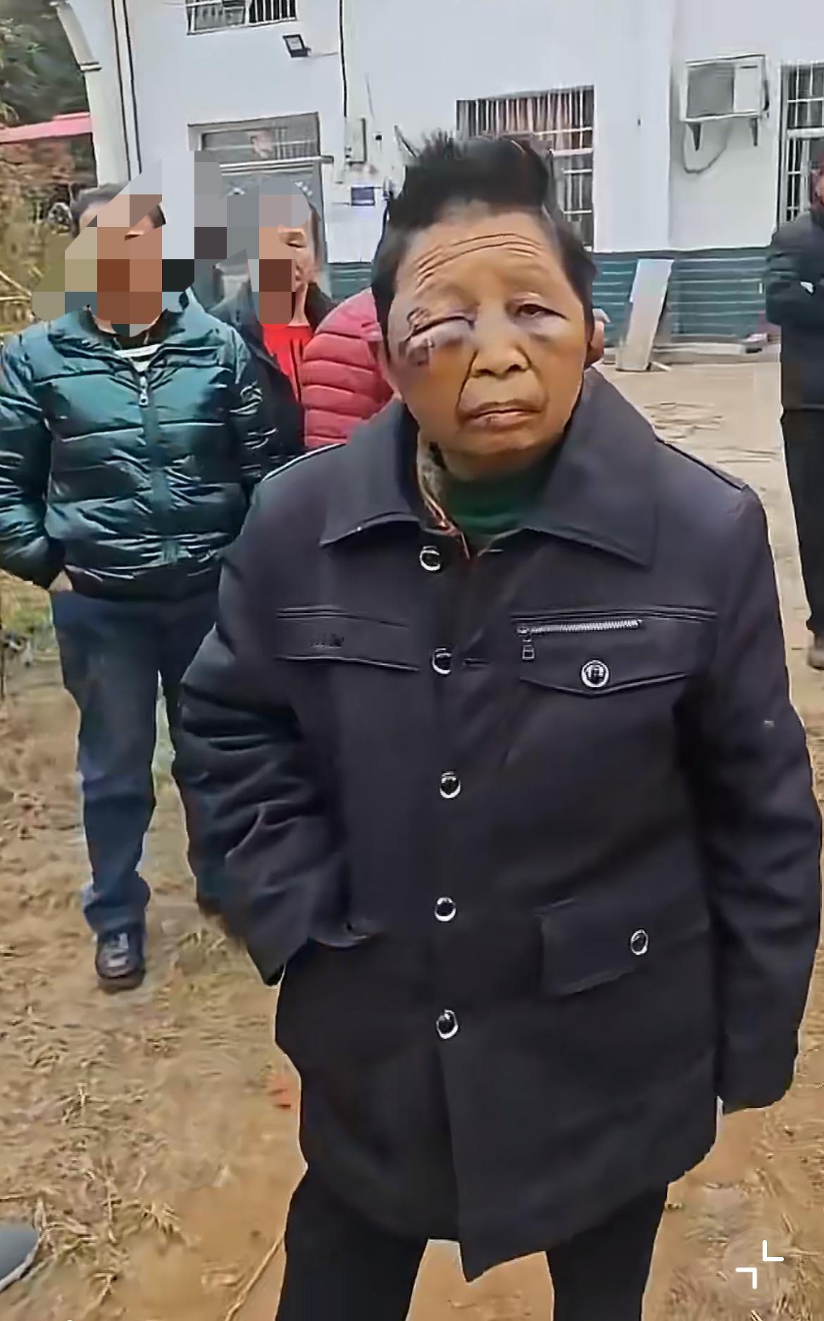 湖南平江70多岁老太被老公打成这样，也太可怜了，她的子女呢？老公大概率是个酒精成