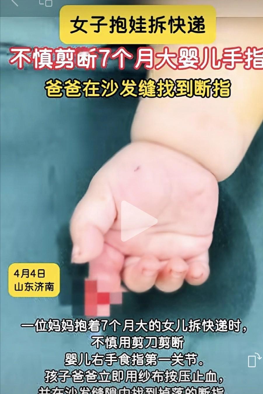 心惊胆战！济南妈妈抱7个月宝宝拆快递，一剪刀剪断宝宝手指，看完再也不敢这么做了！