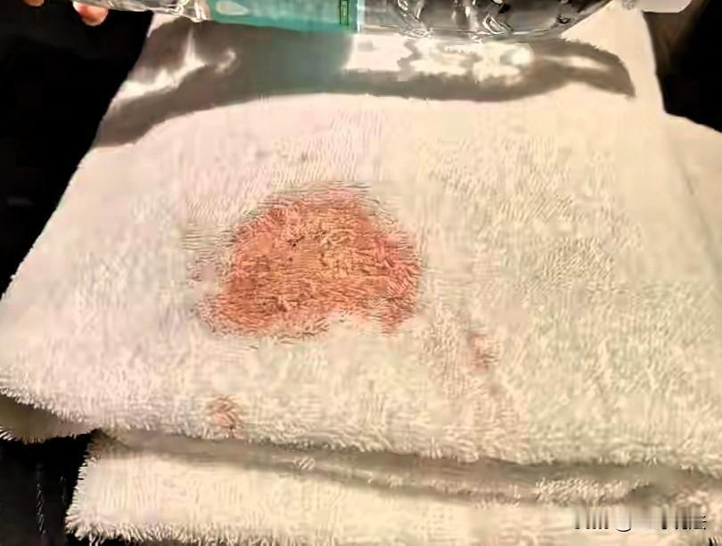 四川成都，一男子入酒店，洗完澡后用浴巾擦身，突然发现浴巾上有一大块血迹，男子通知
