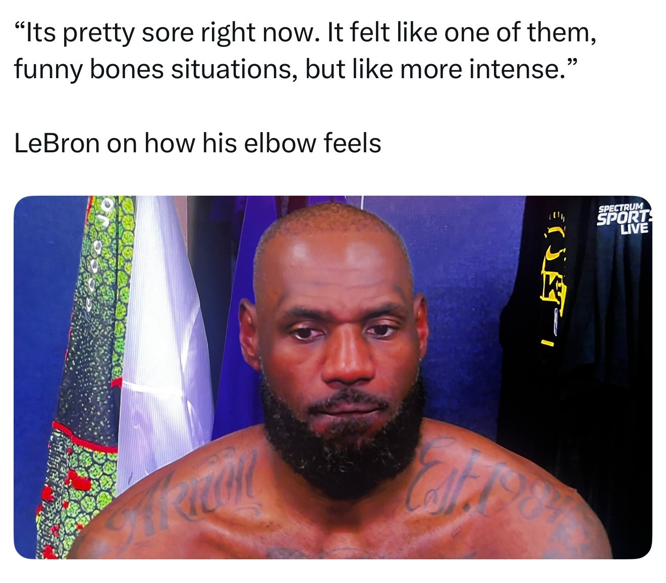 詹姆斯谈到手肘伤势：“现在特别酸痛。感觉就像撞到‘麻筋’那种情况，但痛感更强烈。