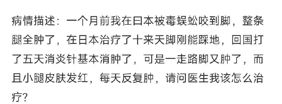 蜈蚣喜欢阴暗潮湿的环境有华人在网上吐槽，去日本工作三个月被蜈蚣咬了四次。在国内