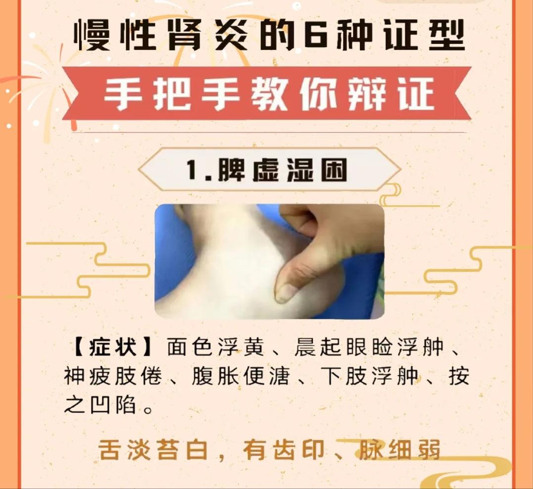 慢性肾炎的6种证型、手把手教你辨证！