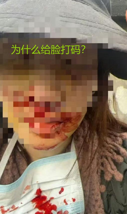 没人觉得金晨不对劲儿吗？不是肇事逃逸的问题，也不是找人顶包的嫌疑，而是她发的那张