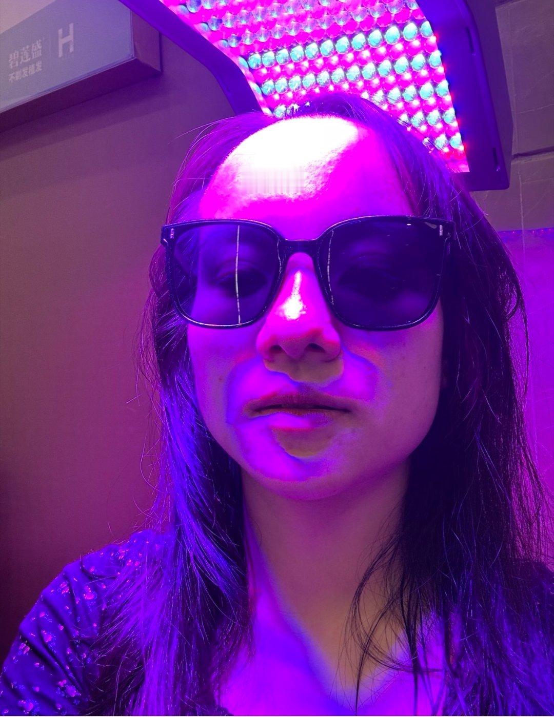 发际线高都有什么烦恼生活笑料撞满怀