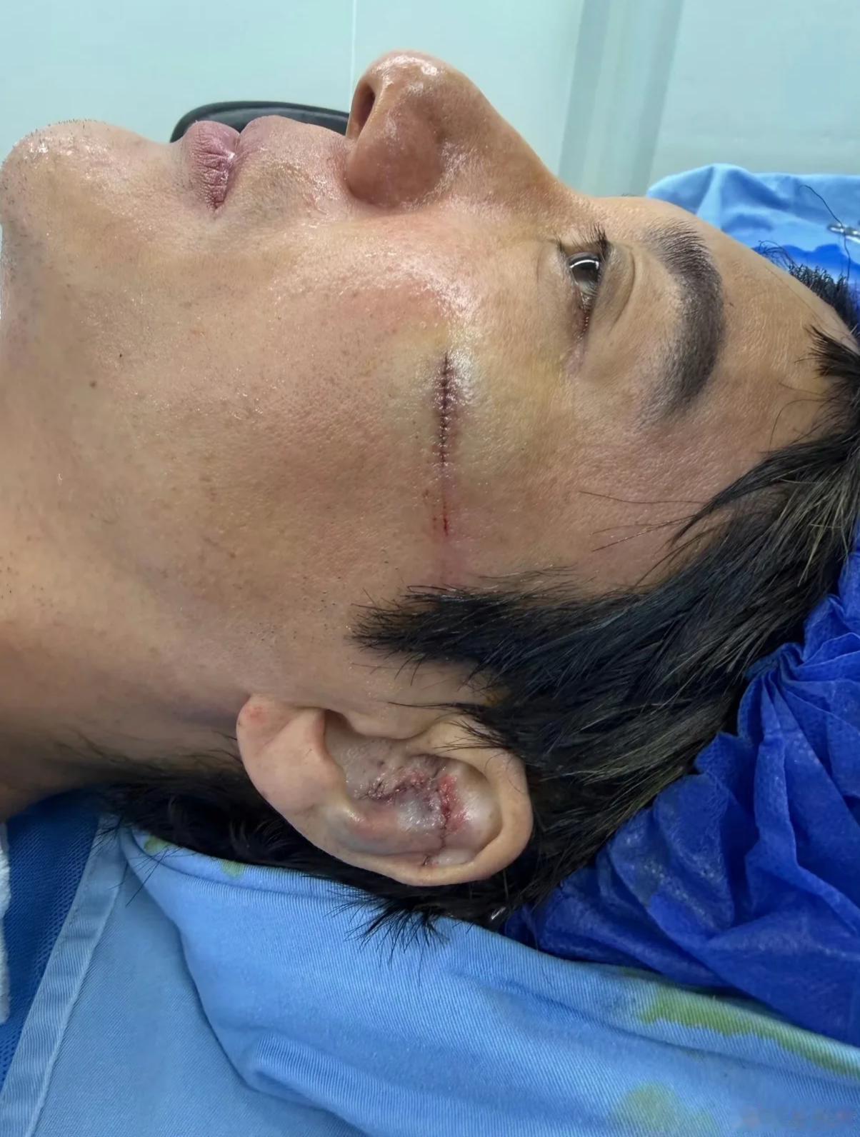 说出来你可能不信，王力宏唱歌居然唱出玄学来了！连着好几场演唱会出意外，次次都