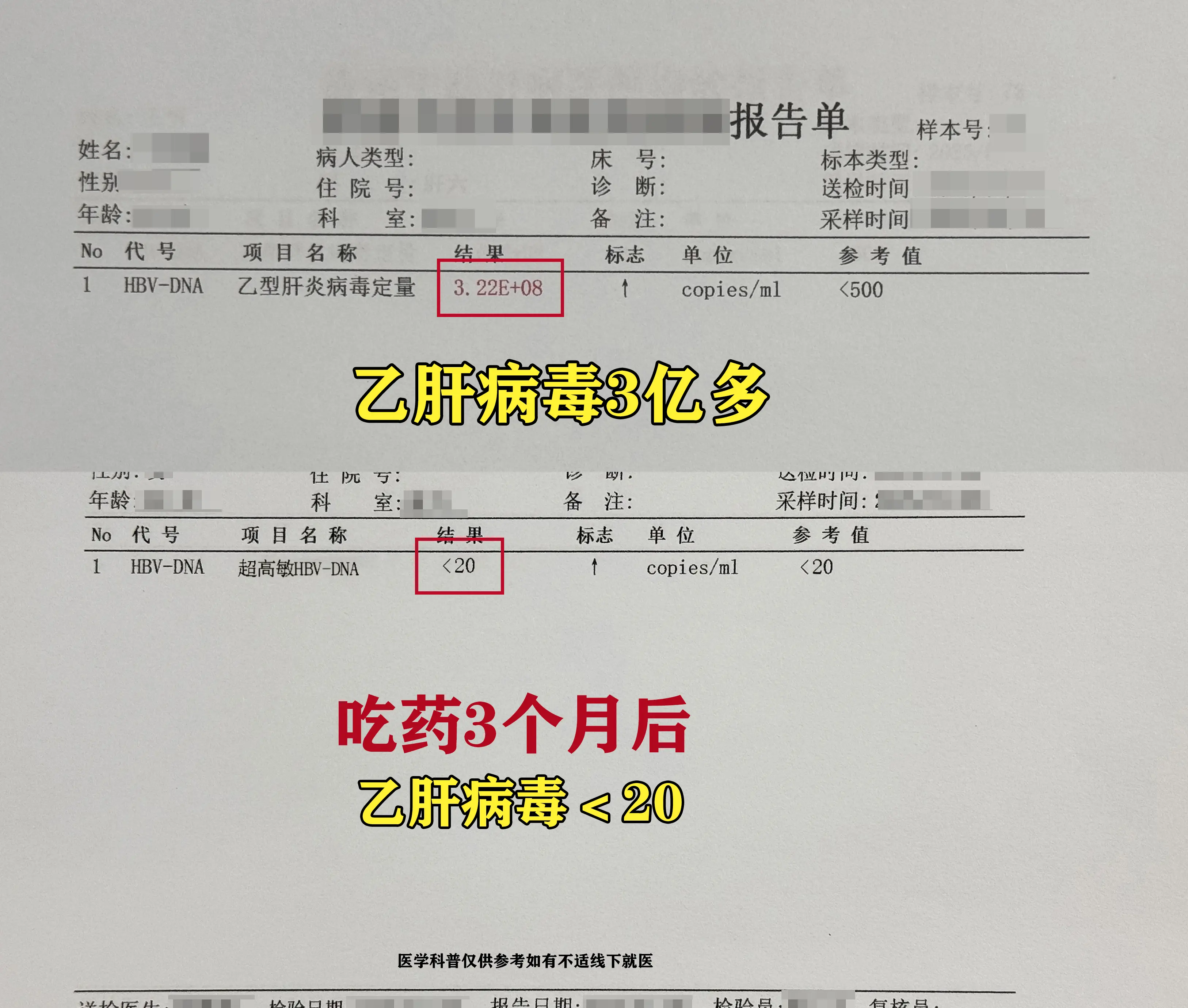这样的乙肝病毒量太多！。“乙肝10多年了，以前一直纠结要不要抗病毒治疗...