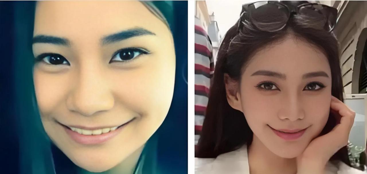 汪小菲妻子被传整容，他咋看？最近，汪小菲妻子马筱梅陷入整容争议。网友翻出旧照对