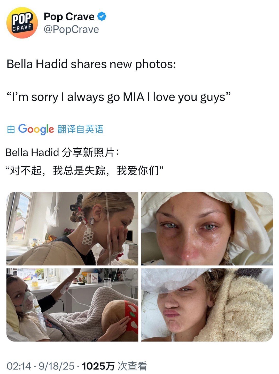 贝拉再因莱姆病入院治疗贝拉患莱姆病超模贝拉BellaHadid因莱姆病再次紧
