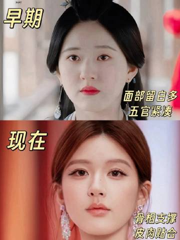 赵露思早期与现在对比 这变化挺大的... 现在真的还是原生脸吗