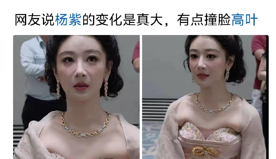 应该是整容了吧，变化太大