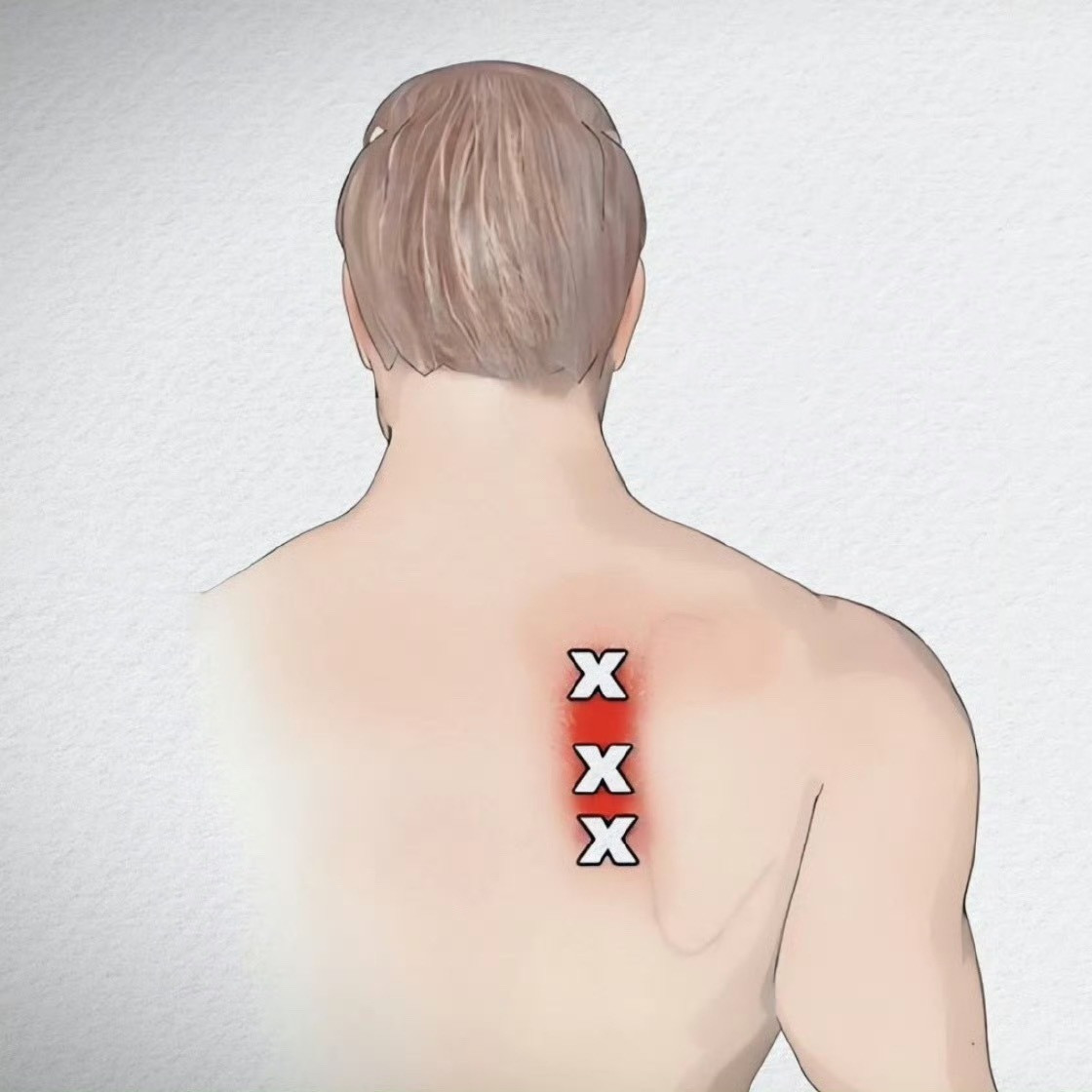 肩颈酸痛最近好多朋友问，一上班就开始肩膀脖子疼，怎么办？先来看示意图123，