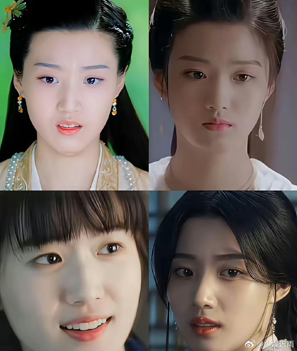 卢昱晓变化好大，是做医美了吗？