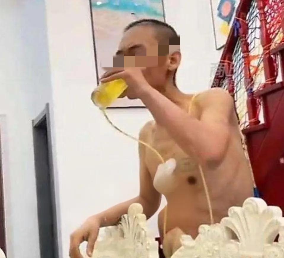 看这画面，心里又酸又涩。四川这位肝癌晚期的男子，放弃治疗后买了一箱啤酒，插着管子