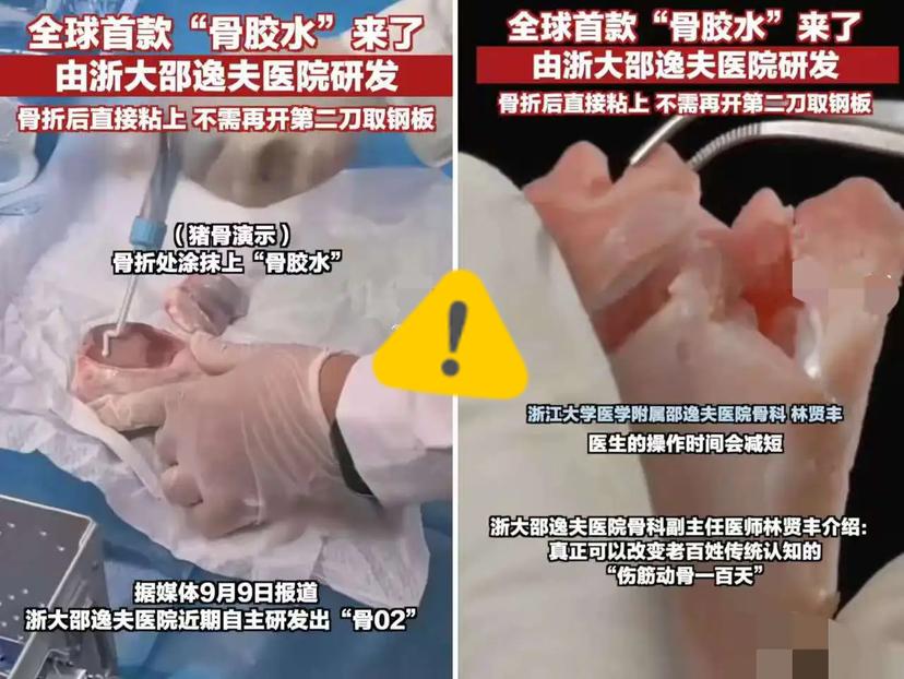 年纪一上来牙齿问题就没断过——松动不敢啃硬的，牙缝大塞东西难受，粘个牙冠还总担心