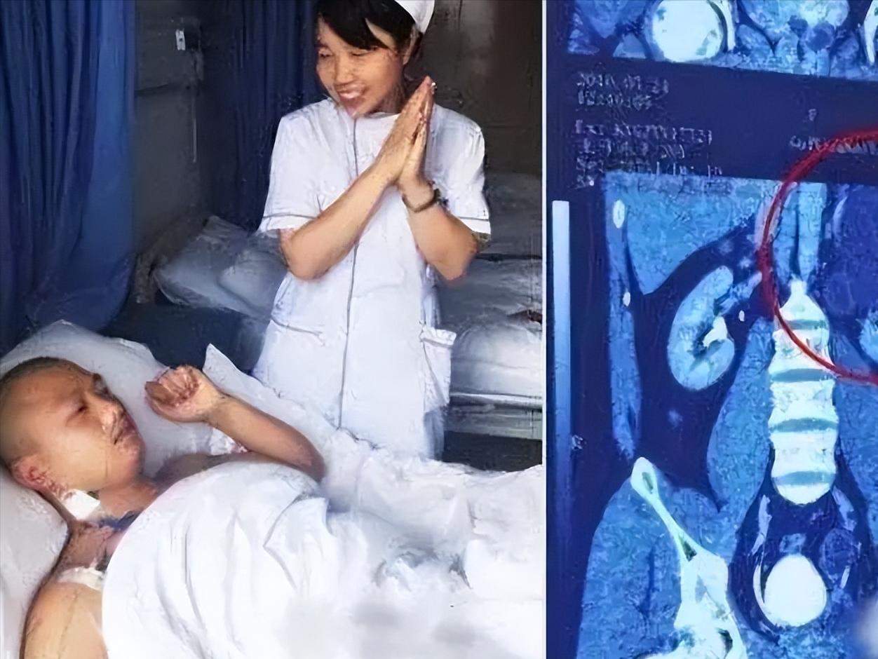 我的丈夫有4个肾！”2016年，贵州一男子天生神力，可以把白酒当水喝，除此之外，