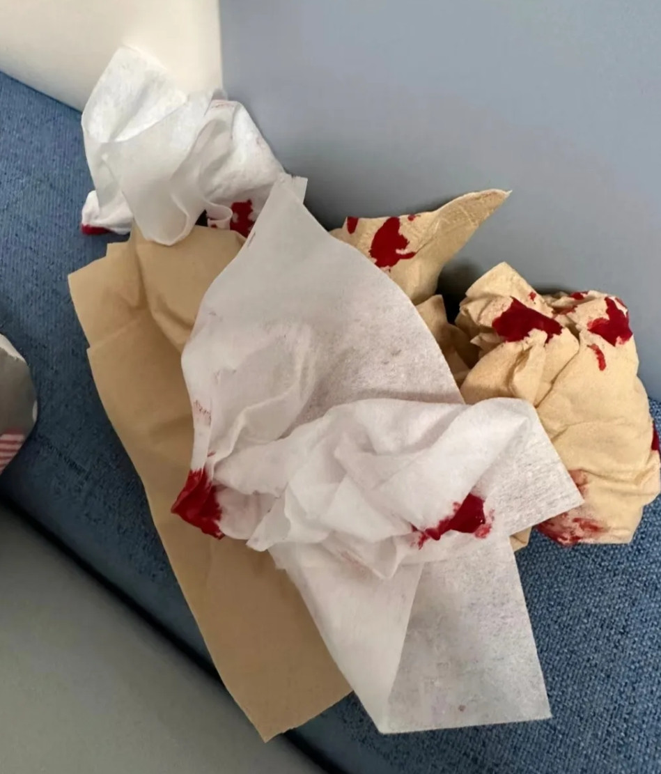 5岁孙女因不会刷碗，被奶奶一巴掌打得流鼻血。父亲回来正好瞧见，怒声道：“她不过