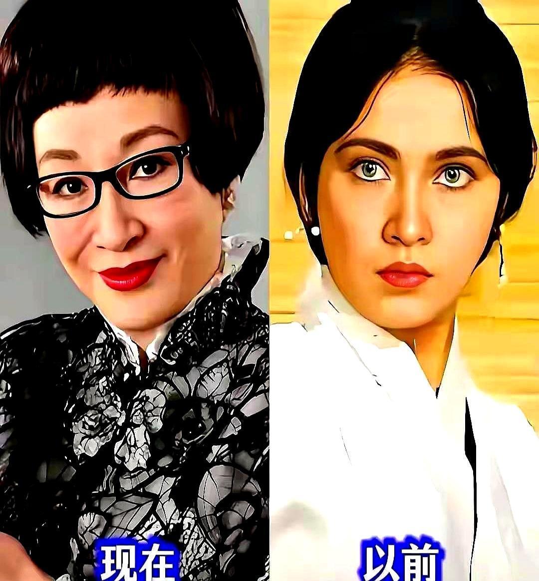 75岁的刘晓庆，骨密度飙到同龄人的172%，医生拿着报告手都抖了。这根本不是奶奶