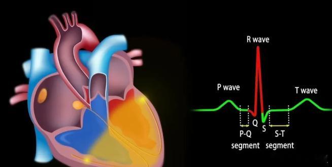让AI看懂心电图：一种生成可信解释的新方法！心电图是诊断心脏疾病的关键工具，人工