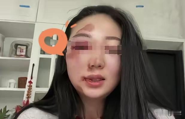 女婿昨天动手打了我女儿，我气得直发抖，拉住他就问原因，质问他凭什么动我的宝贝女儿