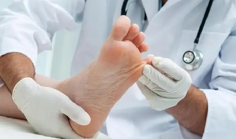 脚趾缝突然奇痒难耐，短短三个月竟从普通脚气直奔灰指甲，免疫低下人群中超五成足癣患