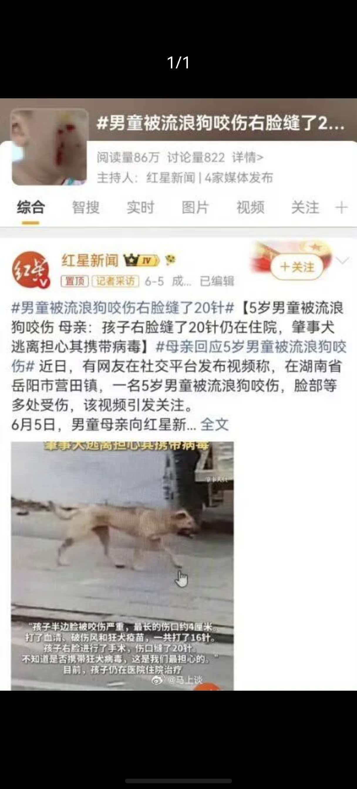 没别的意思啊，我就想问问他疼不疼