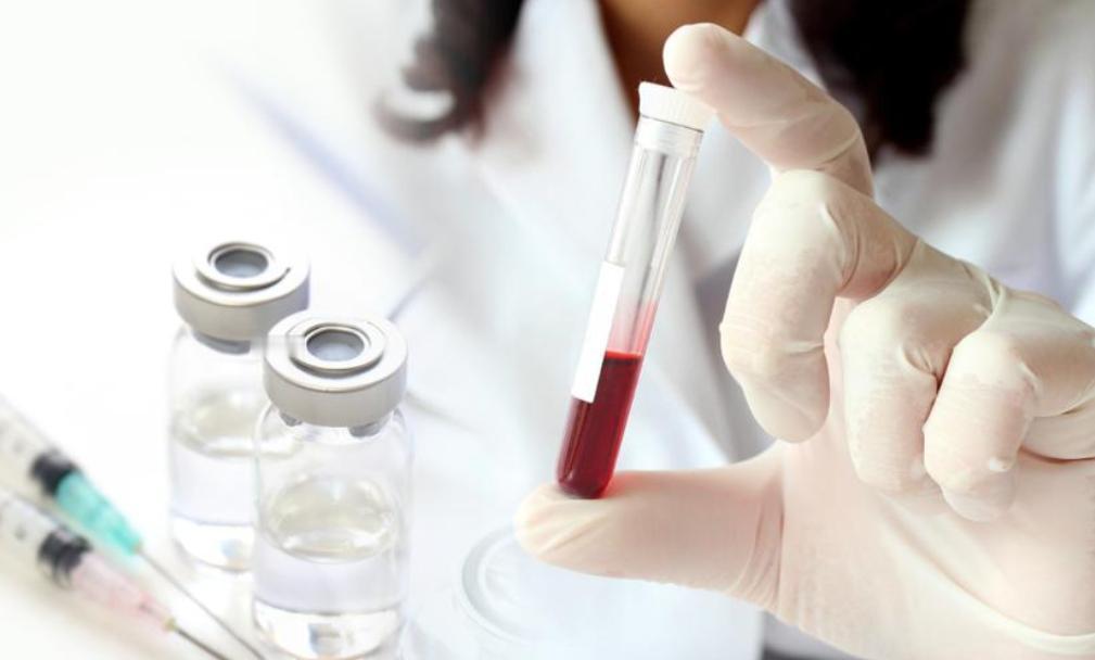 体检报告出现这3个指标异常，当心脑梗心梗！及时干预别忽视体检报告拿到手，大部