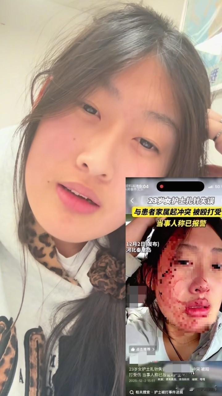 “23岁女护士扎针失误”后续，图片中的女生本人回应，她自己都不知道有这回事，她也