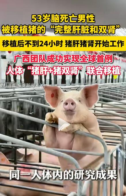 全球首例！广西一帮医生，居然把一整头猪的肝脏，连同两颗猪腰子，一次性移植到了一个