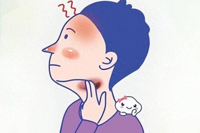 发烧有可能是淋巴瘤吗发烧可能是淋巴瘤的症状之一，但多数情况下发烧由普通感染引