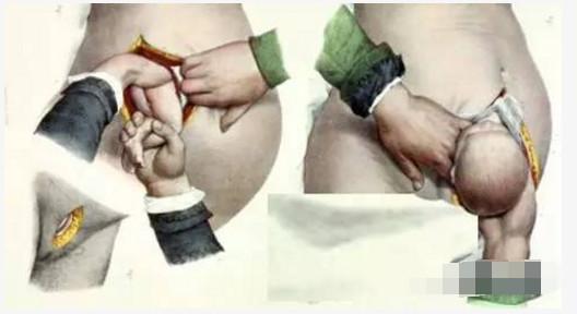 都说顺产很疼, 剖腹产受的罪也少不了多少