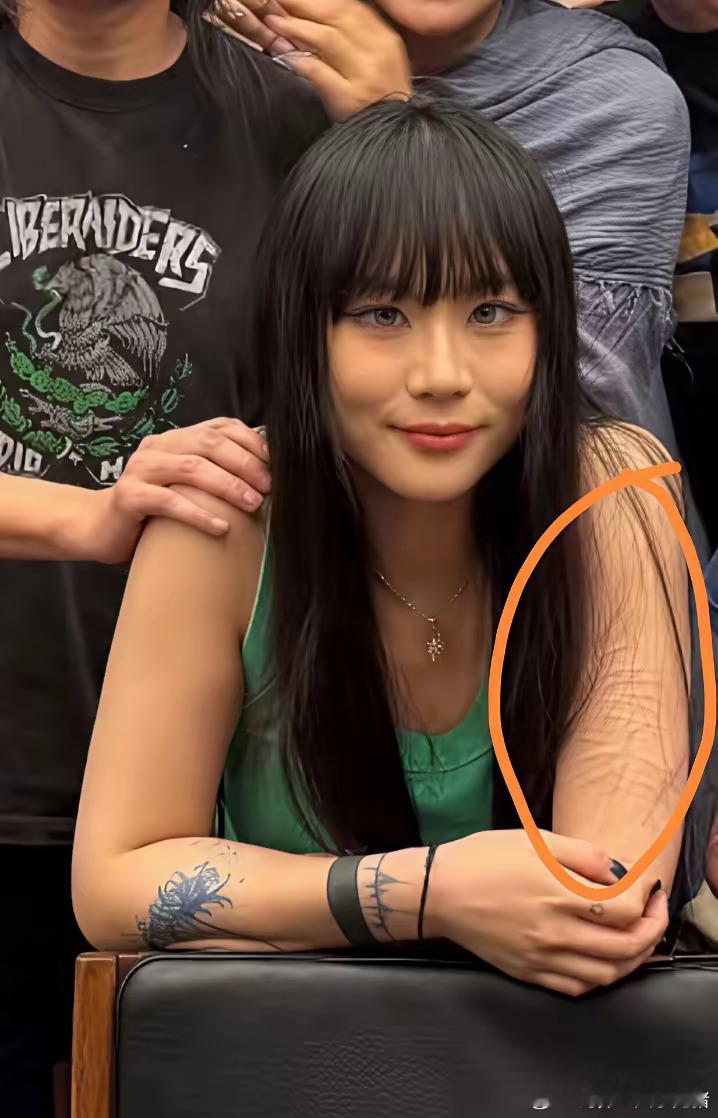 窦唯这个二女儿到底经历了啥？整个手臂上这么多刀疤！​​​