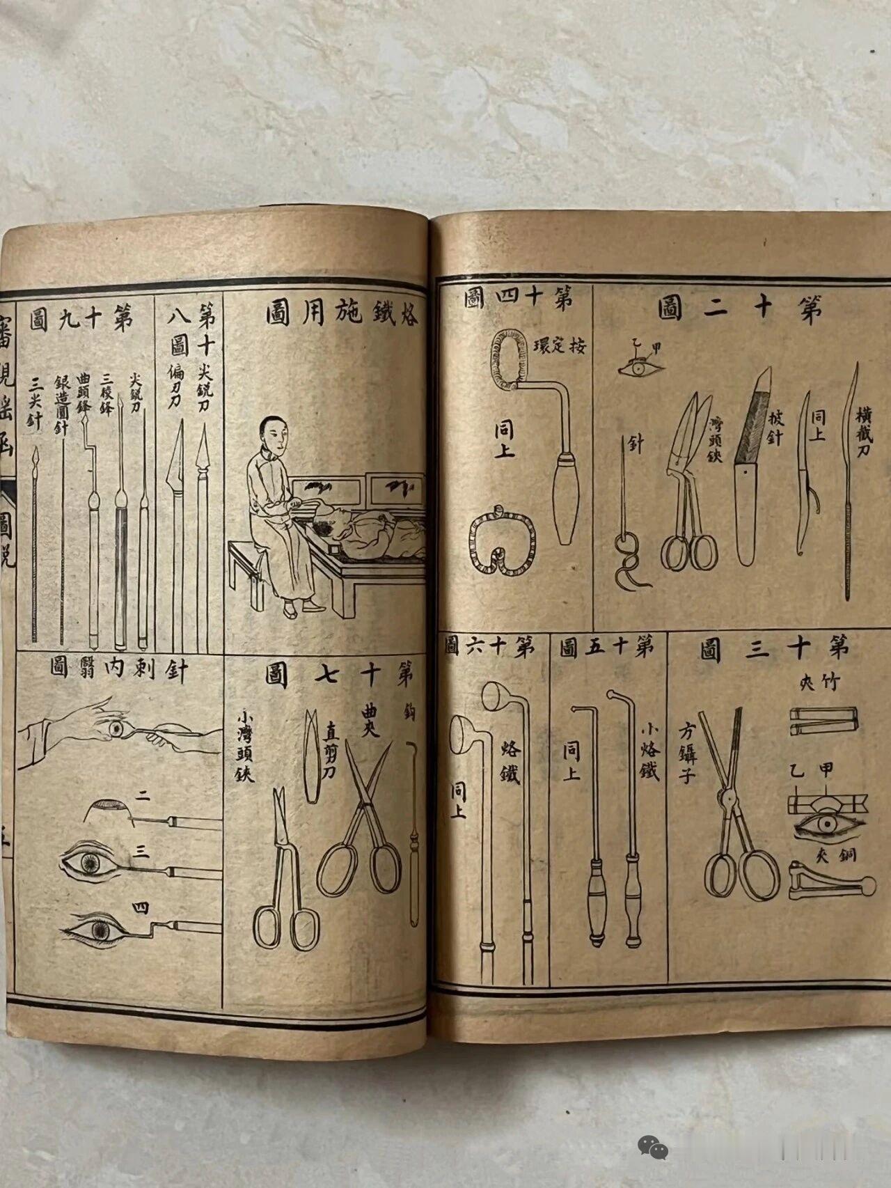 你敢相信，明朝已经有完整的手术！汉代古墓出土的手术简单，最出名的应该就是华佗