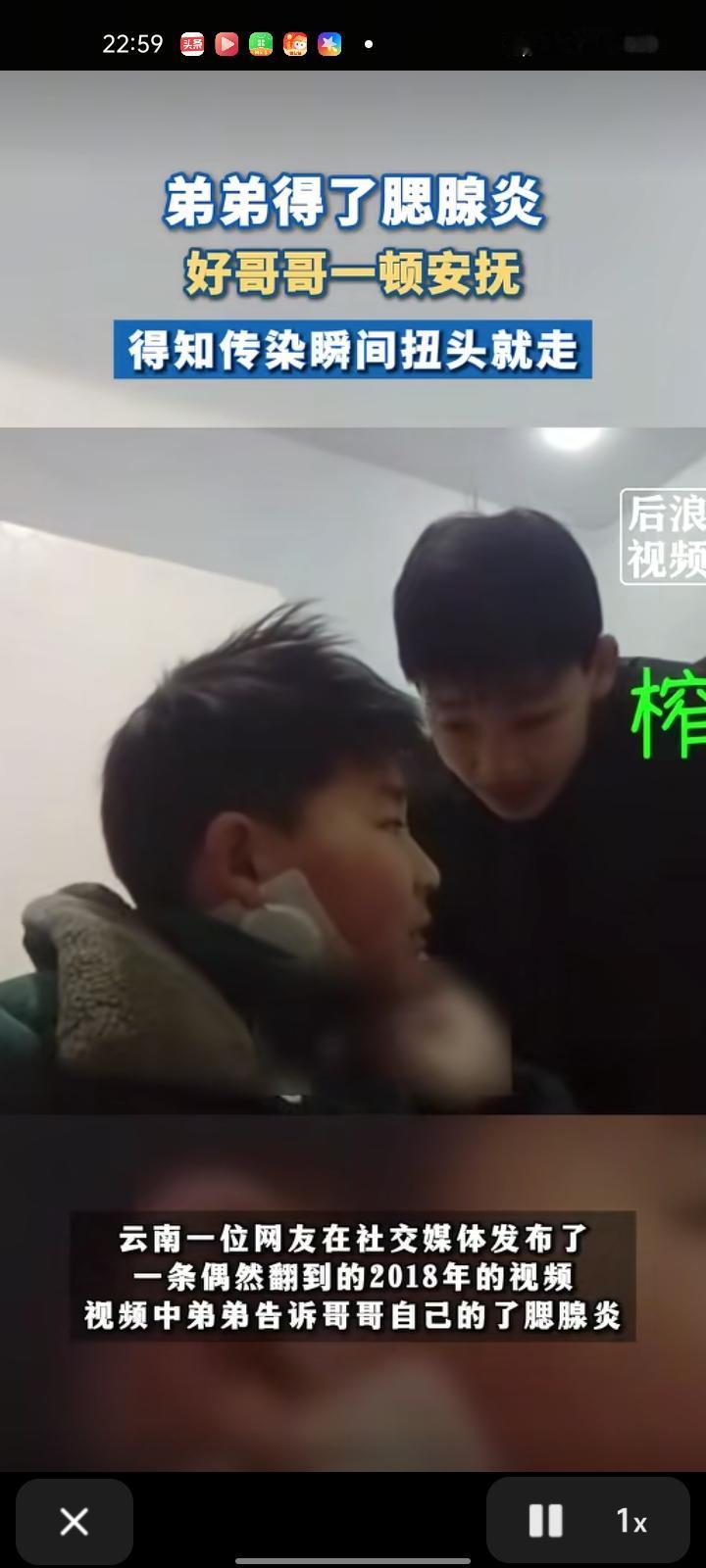 2月10日，云南玉溪。网友发布一条偶然翻到的2018年的视频，视频中弟弟两边脸贴