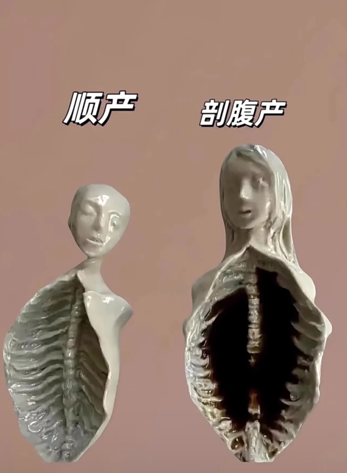 现在知道剖腹产伤害大还是顺产伤害大了吧？