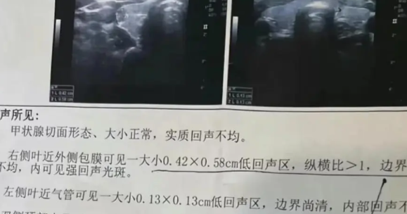 湖北一女子，因找不到对象，被父母安排相亲，万万没想到，在相亲过程中男子贬低女子没