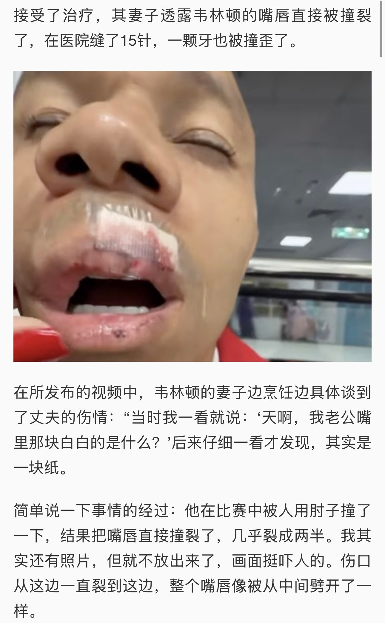 【慎入！！！】新赛季中超第一张红牌的受害者席尔瓦，屏幕里看着被肘击动作不大，其实